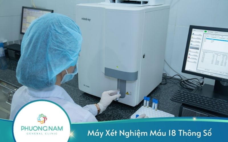 Máy Xét Nghiệm Máu 18 Thông Số Hiện Đại Nhất Hiện Nay