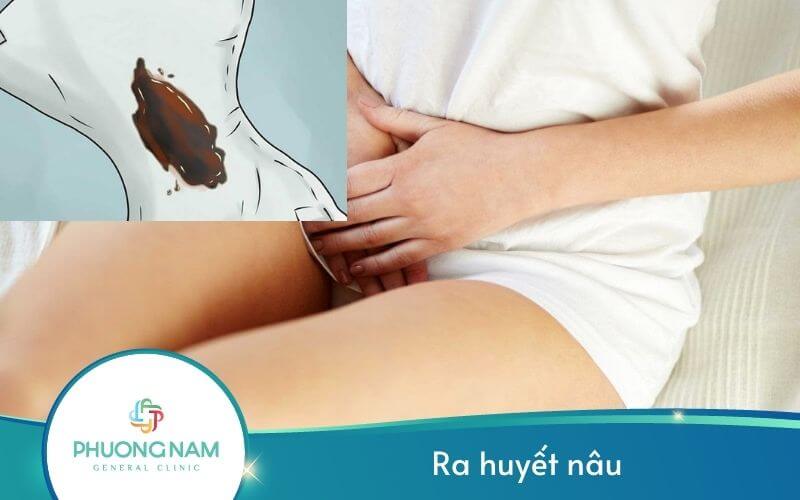 Ra Huyết Nâu – Dấu Hiệu Bệnh Lý Nguy Hiểm