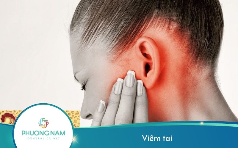 Viêm Tai – Nguyên Nhân, Dấu Hiệu Và Cách Điều Trị Hiệu Quả