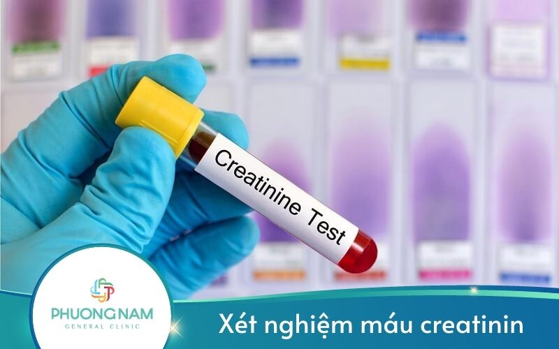 Xét Nghiệm Máu Creatinin – Đánh Giá Tình Trạng Suy Thận Hiệu Quả