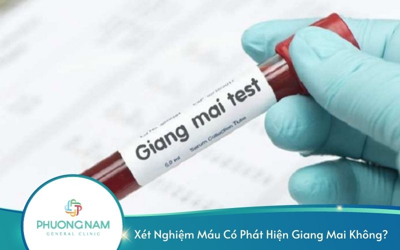 Xét Nghiệm Máu Có Phát Hiện Giang Mai Không?