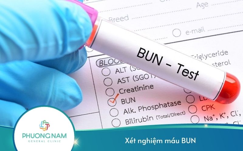Xét Nghiệm Máu BUN – Đánh Giá Chức Năng Gan, Thận Hiệu Quả