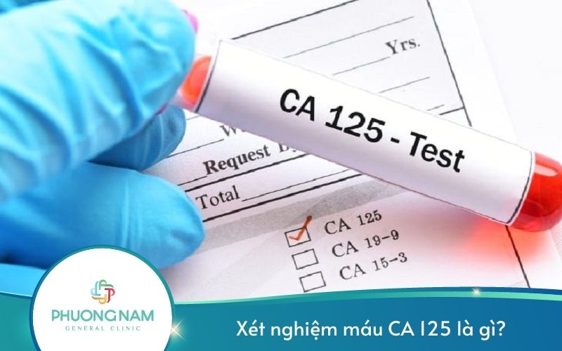 Xét Nghiệm Máu Ca 125 Là Gì?