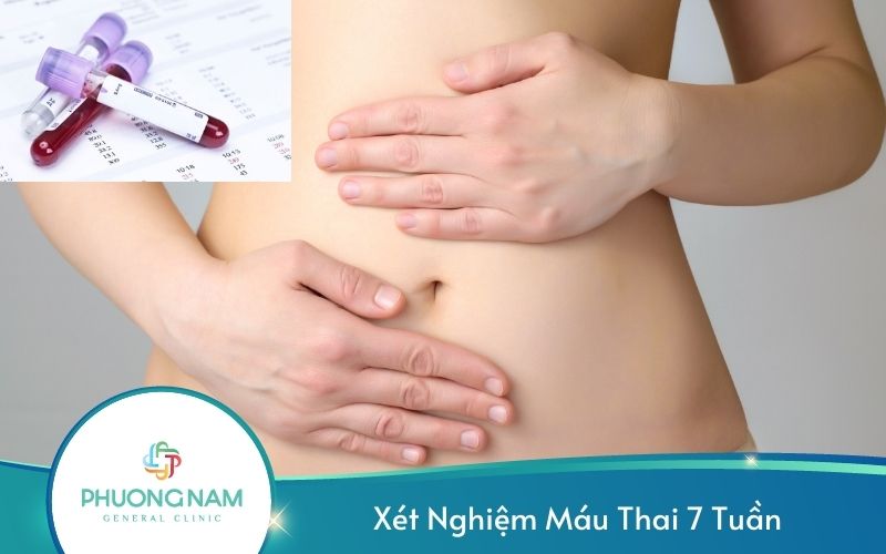 Xét Nghiệm Máu Thai 7 Tuần Để Làm Gì?
