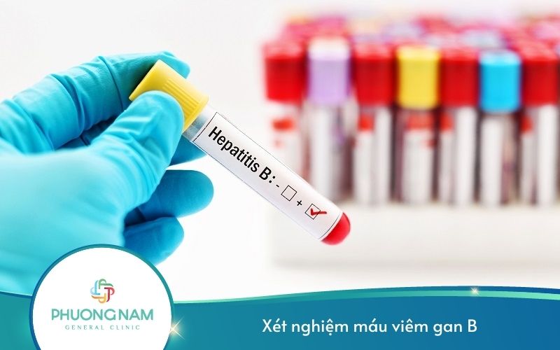 Xét Nghiệm Máu Viêm Gan B Gồm Những Xét Nghiệm Nào?