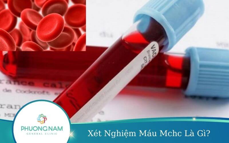 Xét Nghiệm Máu Mchc Là Gì? – Ý Nghĩa Của Chỉ Số Mchc