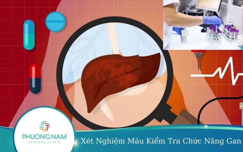 Xét Nghiệm Máu Kiểm Tra Chức Năng Gan
