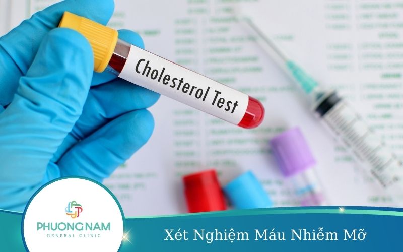 Xét Nghiệm Máu Nhiễm Mỡ Và Ý Nghĩa Của Xét Nghiệm Mỡ Máu