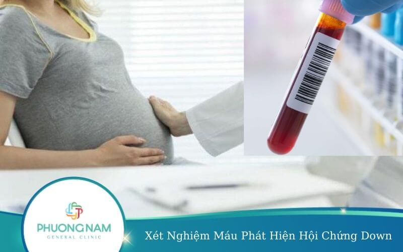 Xét Nghiệm Máu Phát Hiện Hội Chứng Down – Những Điều Cần Biết