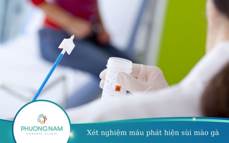 Xét Nghiệm Máu Phát Hiện Sùi Mào Gà