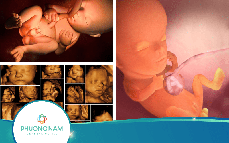 [Giải Đáp Nhanh] Nhìn hình siêu âm làm sao biết trai hay gái?