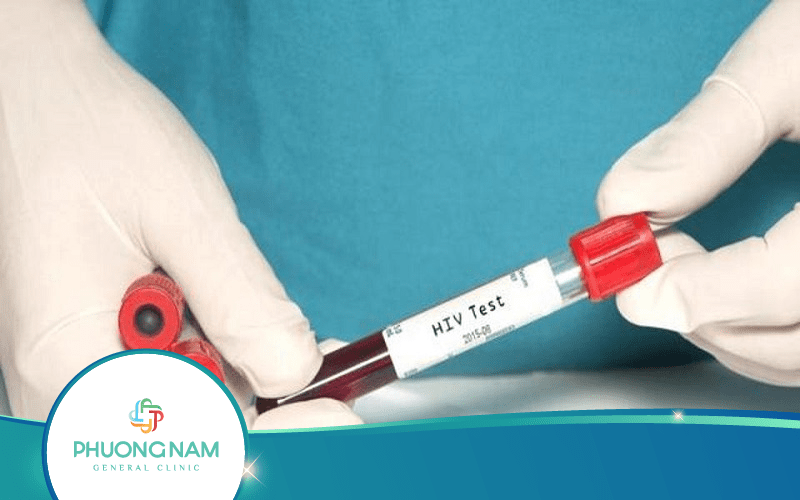 Xét Nghiệm Test Nhanh HIV – [Tổng Hợp Thông Tin Cần Biết]