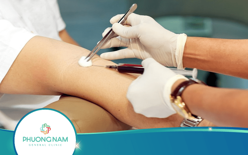 【Giải Đáp】Những điều lưu ý trước khi xét nghiệm máu giúp kết quả chính xác