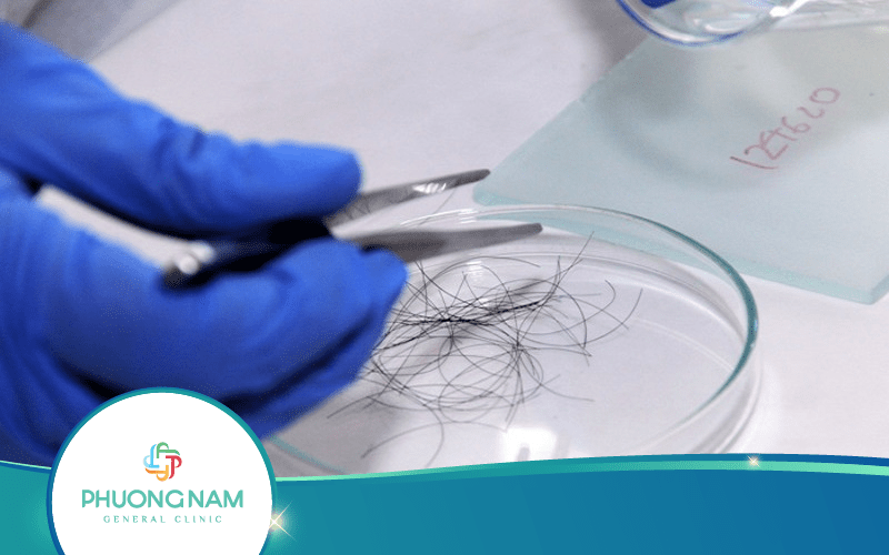 Xét Nghiệm ADN Bằng Tóc Có Chính Xác Không?