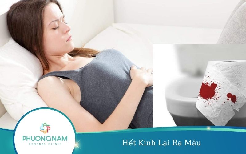 Hết Kinh Lại Ra Máu – Tìm Hiểu Ngay Nguyên Nhân