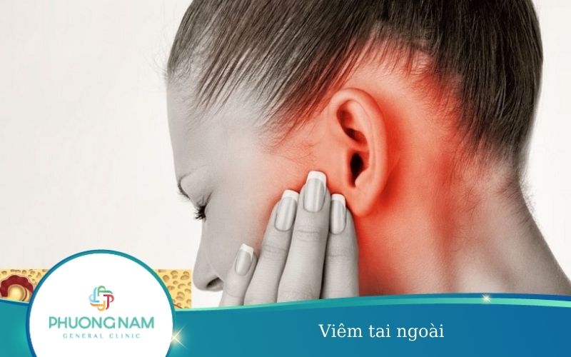 Viêm Tai Ngoài – Nguyên Nhân, Triệu Chứng, Cách Khắc Phục