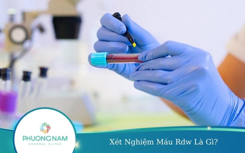 Xét Nghiệm Máu Rdw Là Gì?