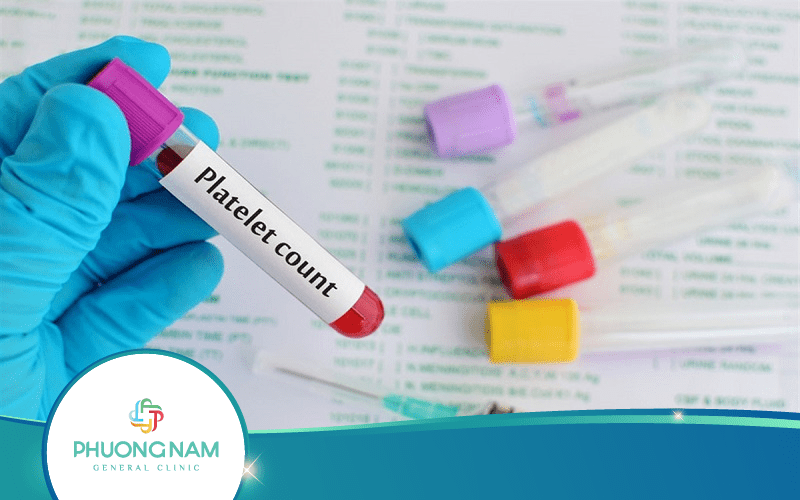 Chỉ Số PLT Trong Xét Nghiệm Máu Là Gì? Thực Hiện Khi Nào?