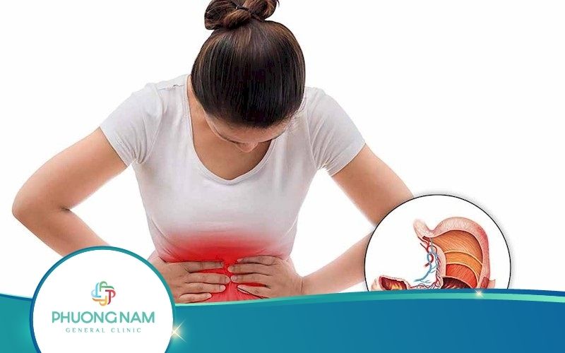 [Cảnh Báo] Đừng Chủ Quan Với Bệnh Viêm Loét Dạ Dày