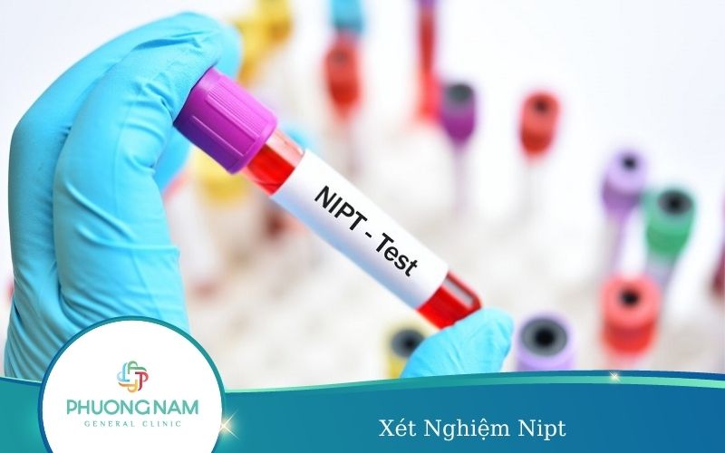 Xét Nghiệm Nipt: An tâm thai kỳ, mẹ khỏe con yêu