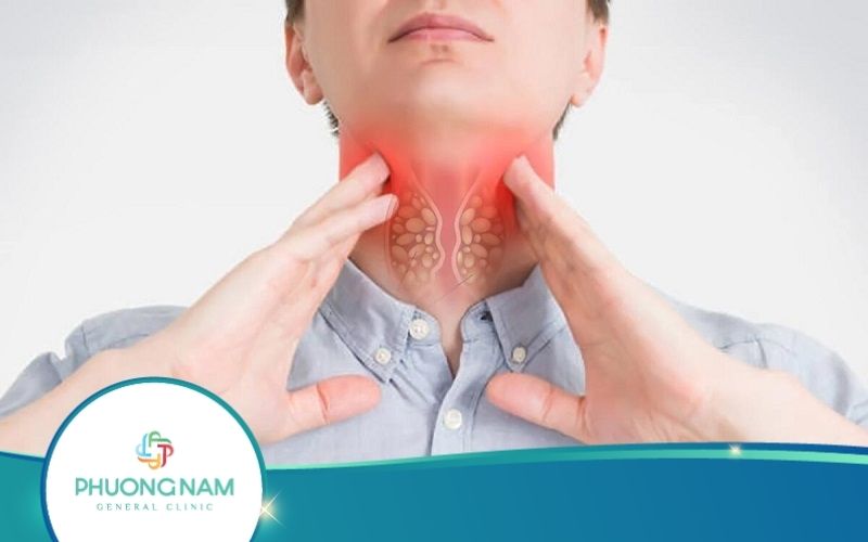 Đau Họng Lâu Ngày Không Khỏi Phải Làm Sao?