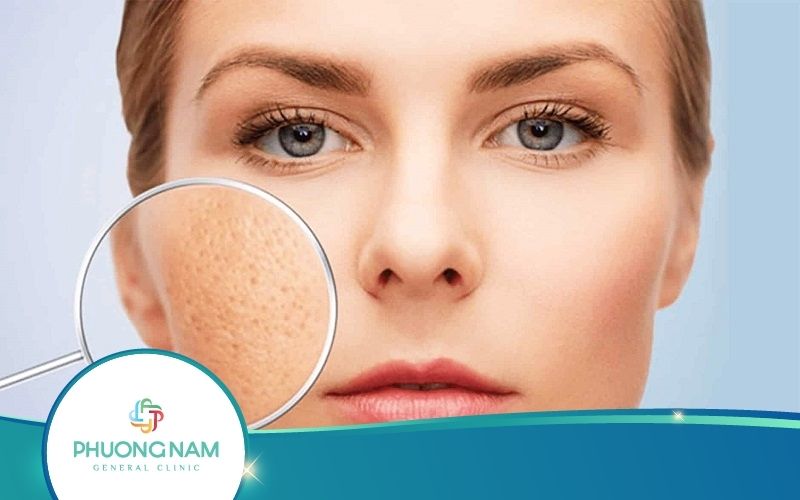 Bật Mí Cách Chăm Sóc Da Hỗn Hợp Mùa Hè Để Da Luôn Đẹp
