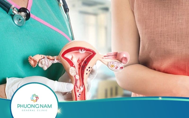 Ung Thư Cổ Tử Cung – Nguyên Nhân, Triệu Chứng, Cách Phòng Ngừa