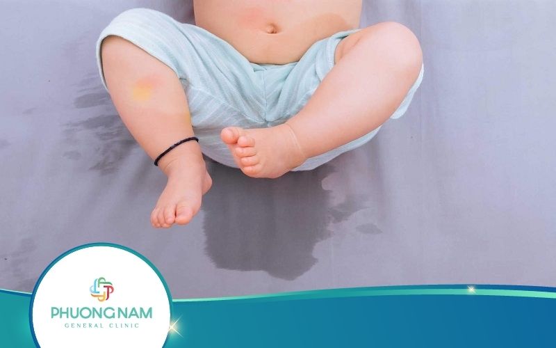 Chữa Đái Dầm Bằng Rau Ngót Có Hiệu Quả Như Lời Đồn?