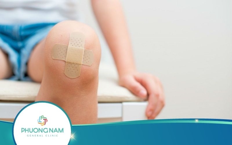 Tiết Lộ Bí Kíp Làm Sao Để Da Non Hết Đỏ Và Không Để Lại Sẹo?