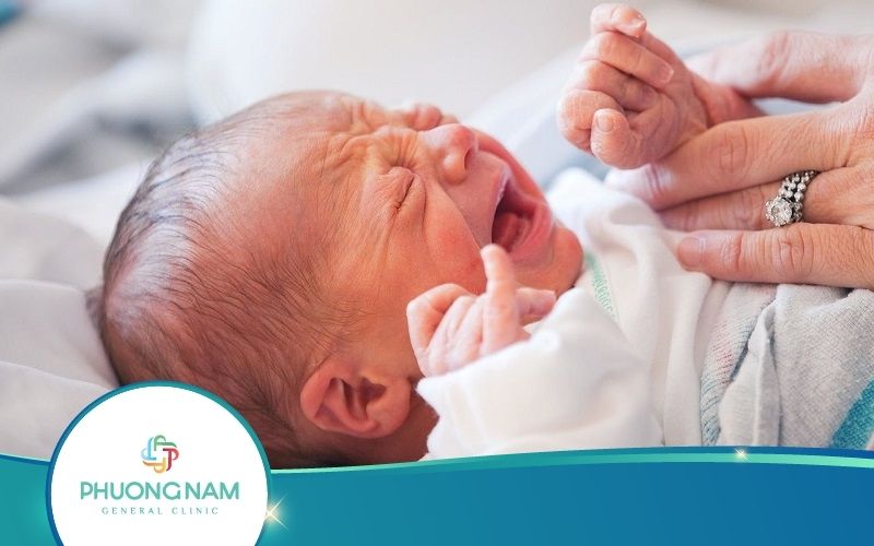 Mẹ Cần Hiểu Đúng Về Sài Đẹn Ở Trẻ Sơ Sinh