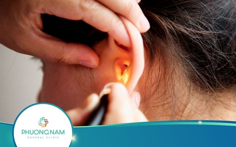 Tai Có Mùi Hôi – Nguyên Nhân Và Cách Khắc Phục