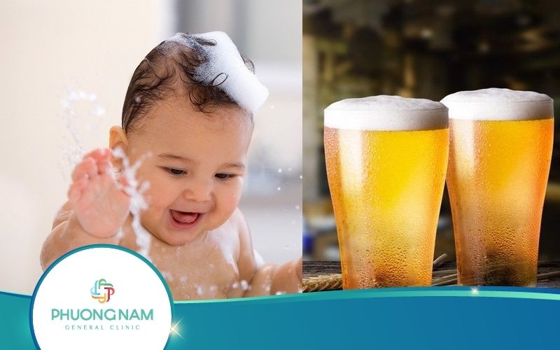 Mẹ Có Nên Tắm Bia Cho Trẻ Sơ Sinh Hay Không?