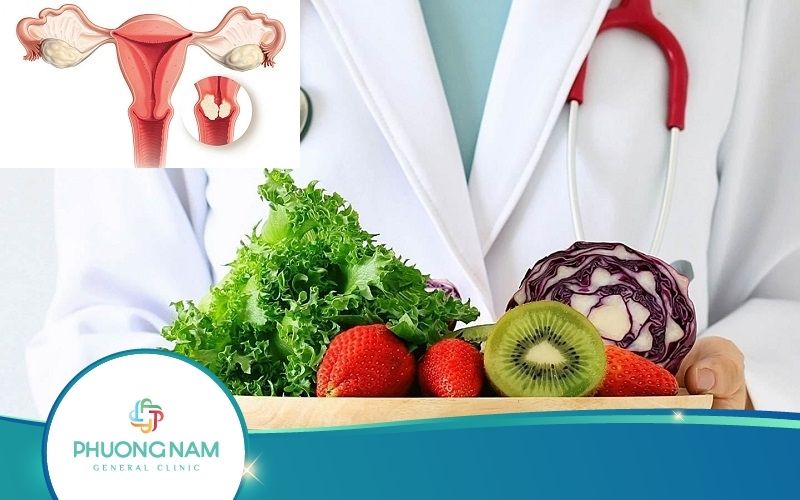Top 10 Loại Thực Phẩm Chống Ung Thư Cổ Tử Cung Hiệu Quả