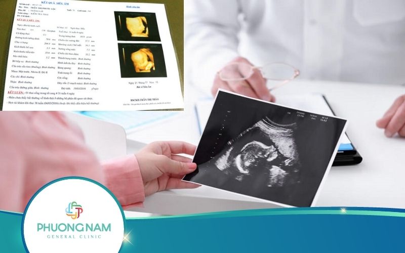Hướng Dẫn Cách Xem Các Ký Hiệu Trong Siêu Âm Thai