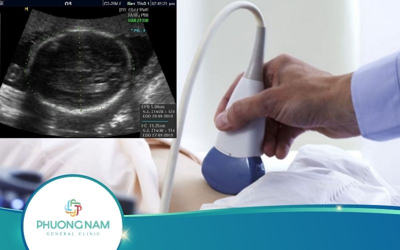 Đường Kính Lưỡng Đỉnh Ở Thai Nhi Là Gì? – Những Điều Mẹ Bầu Nên Biết