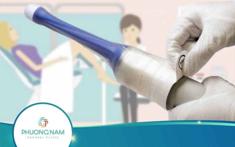 Siêu Âm Đầu Dò Có Phát Hiện Dính Tử Cung Không?