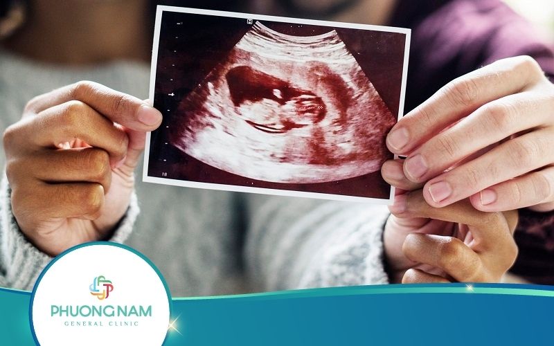 Siêu Âm Giới Tính Tuần 15 Có Chính Xác Hay Không?