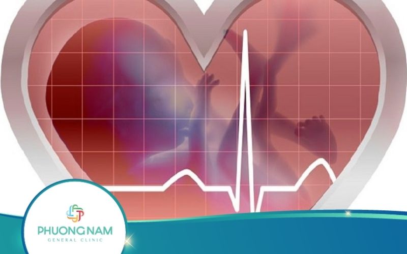 Siêu Âm Không Có Tim Thai Phải Làm Sao?