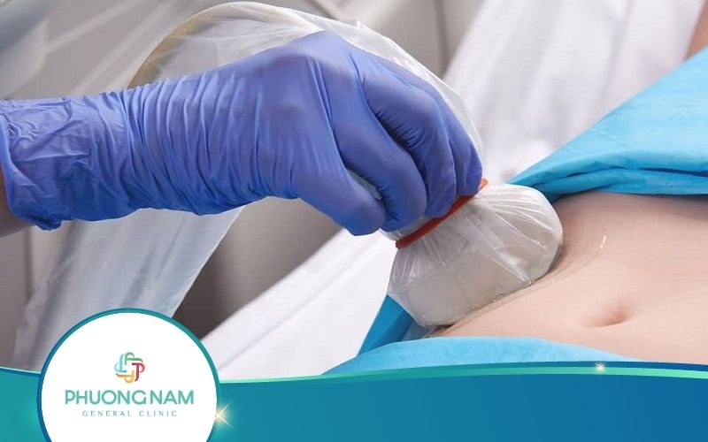 Siêu Âm Sau Chuyển Phôi 28 Ngày Như Thế Nào?