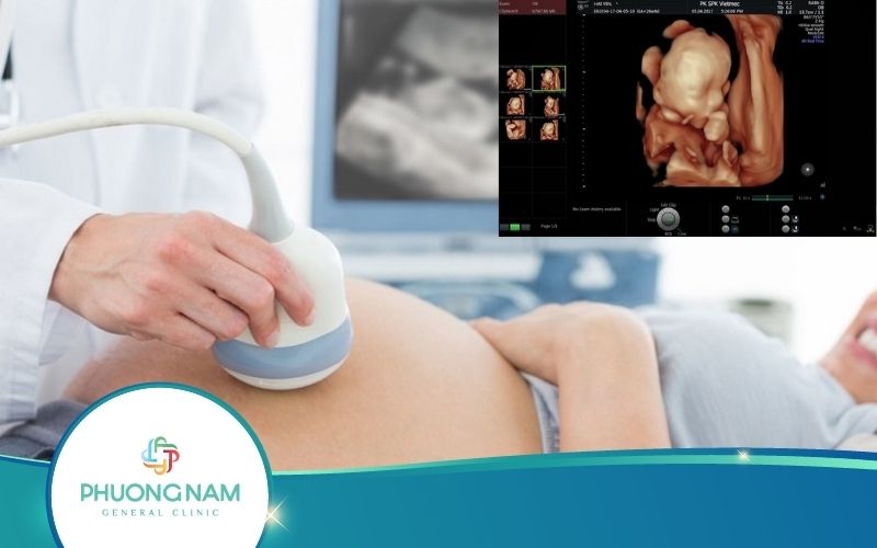 Ý Nghĩa Siêu Âm Thai 34 Tuần Tuổi Bạn Sẽ Tiếc Nếu Không Biết
