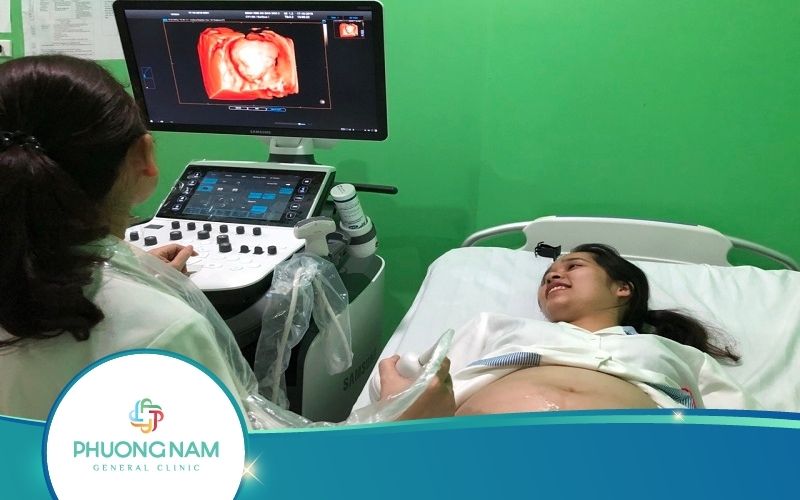 [Giải Đáp] Siêu Âm Thai 5D Giá Bao Nhiêu?