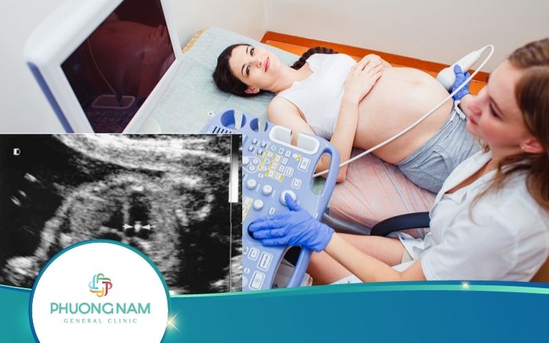 Siêu Âm Thai Có Nốt Phản Âm Sáng Phải Làm Sao?