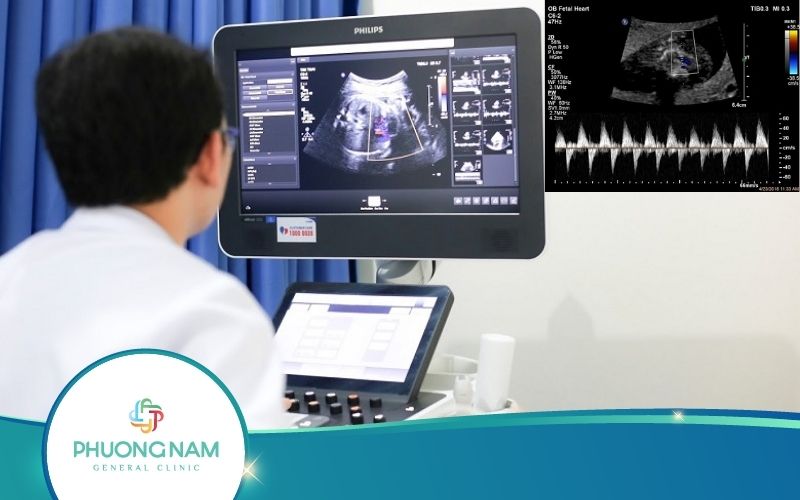 Chỉ Số AFI Trong Siêu Âm Thai Là Gì? Cách Đo Như Thế Nào?