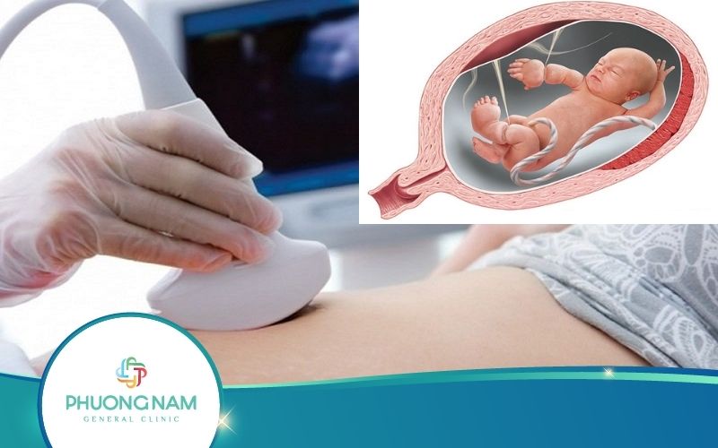 Siêu Âm Thai Có Vách Ngăn Nguy Hiểm Không?