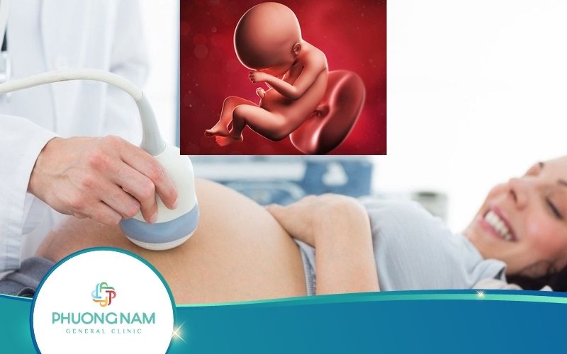 Tìm Hiểu Về Trường Hợp Siêu Âm Thai Không Thấy Mặt Bé