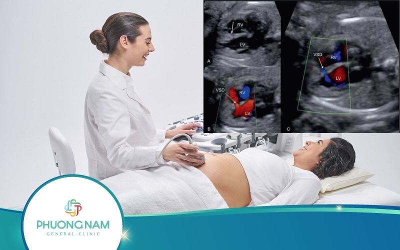 Siêu Âm Thai Nhi Bị Thông Liên Thất Như Thế Nào?