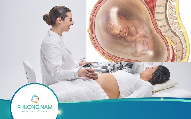 Siêu Âm Thấy Nước Ối Đục Có Nguy Hiểm Không?