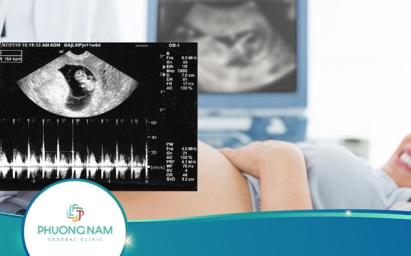 [Giải Đáp] Siêu Âm Tim Thai Dương Tính Có Nghĩa Là Gì?