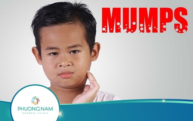 [Giải Đáp] Bệnh Quai Bị Có Nổi Hạch Không?