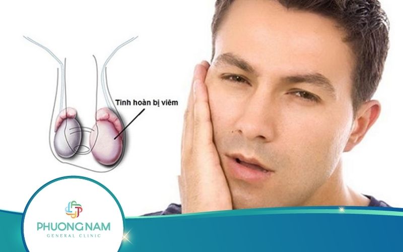 [Giải Đáp] Bệnh Quai Bị Gây Vô Sinh Không?